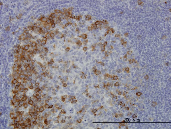 ERIC-1 / TACC3 Antibody (clone 6C4)