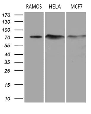 DCP1B Antibody (aa167-473, clone OTI1B5)