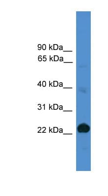 CD8A / CD8 Alpha Antibody (aa61-110)