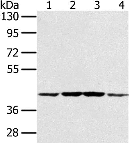 Polyclonal Rabbit anti-Human PAICS / ADE2 Antibody (IHC, WB)