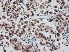 Monoclonal Mouse anti-Human RBBP7 / RbAp46 Antibody (clone OTI5A4, IHC, WB)