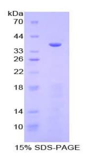Human MEP1A / Meprin Alpha Protein (Recombinant His-T7)
