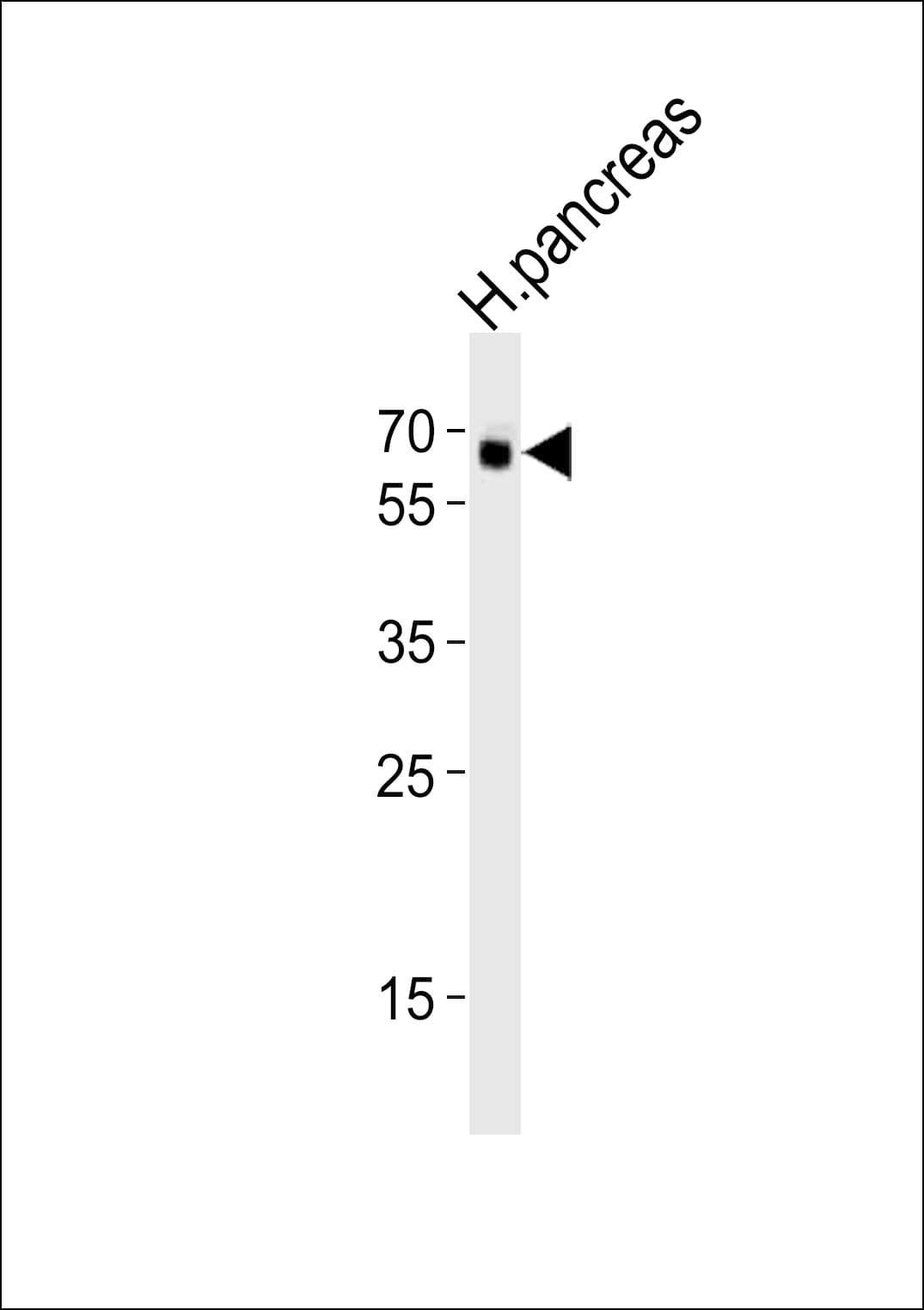 IHC-plus™ ACTRIIB / ACVR2B Antibody (aa1-30)