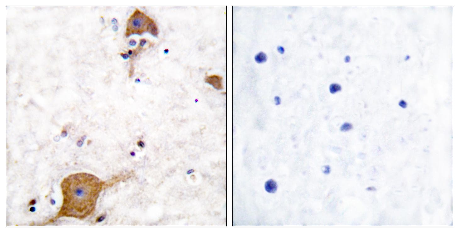 NRG1 / Heregulin / Neuregulin Antibody