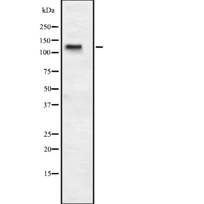 PPP1R13B Antibody