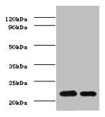 Polyclonal Rabbit anti-Human TIMP1 Antibody (IHC, WB)