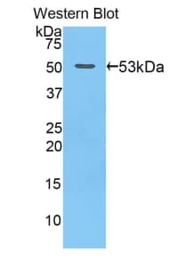 GZMB / Granzyme B Antibody (aa16-244)