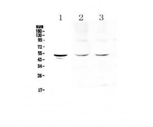TPH1 / Tryptophan Hydroxylase Antibody