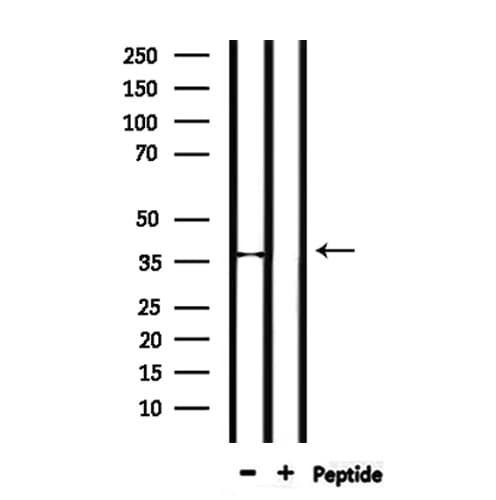 Polyclonal Rabbit anti-Human SFRP-3 / FRZB Antibody (IHC, WB)
