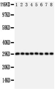 CISH / SOCS Antibody (aa241-258)