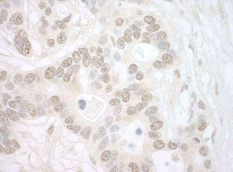 Polyclonal Rabbit anti-Human IPO4 Antibody (aa900-950, IHC)