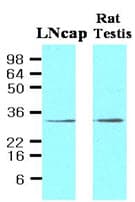 IHC-plus™ Monoclonal Mouse anti-Human STEAP1 / STEAP Antibody (clone J2D2, aa1-70, IHC, IF, WB)
