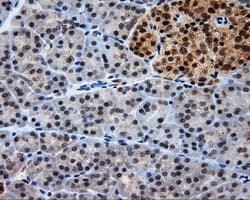 LIPG / Endothelial Lipase Antibody (clone OTI7C2)