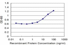 TNNI1 Antibody (clone 4G6)