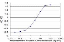 Monoclonal Mouse anti-Human TROVE2 Antibody (clone 2E10, WB)