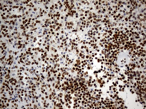 Monoclonal Mouse anti-Human HNRNPH1 / hnRNP H Antibody (clone OTI4F10, Carrier-free, IHC, WB)