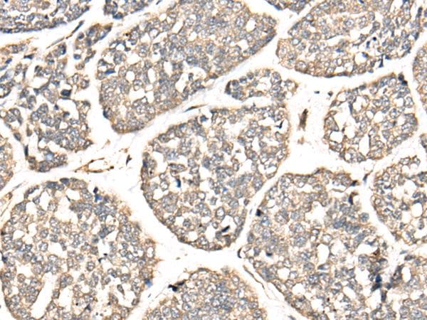 Polyclonal Rabbit anti-Human VTI1B Antibody (IHC, WB)