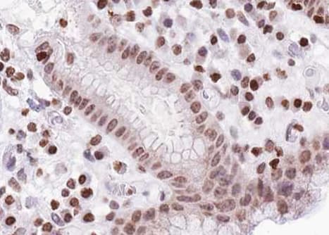 FOXO1 / FKHR Antibody (phospho-Thr24,pThr32)