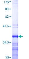Human YBX3 / CSDA Protein (Recombinant GST, N-terminus)