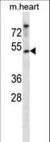 CSNK1E / CK1 Epsilon Antibody (aa283-310)