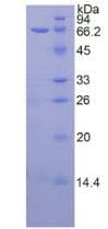 Human TERT / Telomerase Protein (Recombinant His-GST)