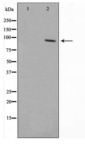 ZNF148 / ZBP-89 Antibody
