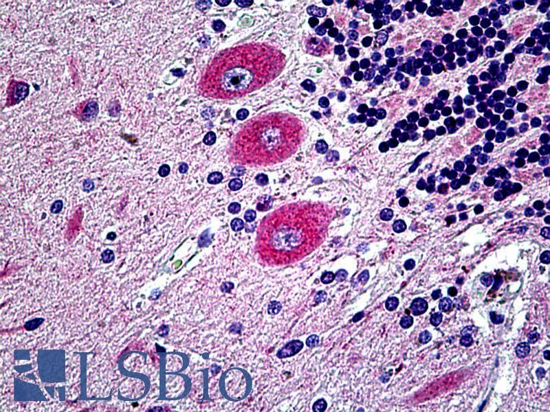 IHC-plus™ EPHB6 / EPH Receptor B6 Antibody (aa831-843)