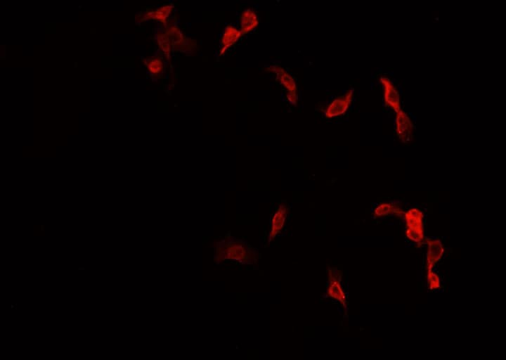 NR4A1 / NUR77 Antibody