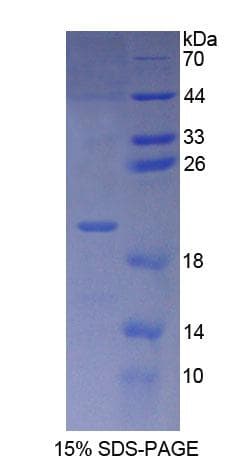 Human POMP / HSPC014 Protein (Recombinant His-T7)