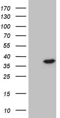 PSMA7 Antibody (clone OTI9B6)