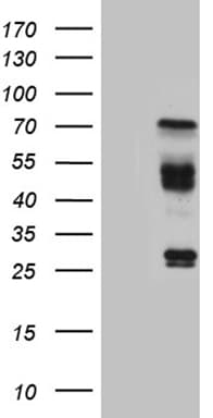 HABP2 Antibody (aa33-330, clone OTI2B5, Carrier-free)