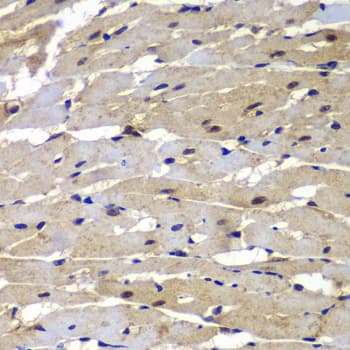 IHC-plus™ Polyclonal Rabbit anti-Human PSMB8 / LMP7 Antibody (IHC, IF, WB)