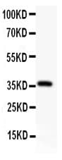 Alpha-Fetoprotein Antibody (aa378-609)