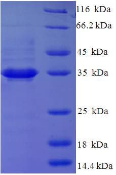 Human QPCTL Protein (Recombinant His-SUMO)