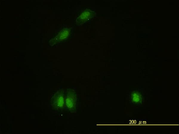 IHC-plus™ CAMK4 / CaMK IV Antibody (clone 1A3)