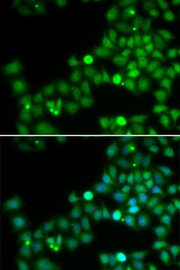 POLK / DNA Polymerase Kappa Antibody