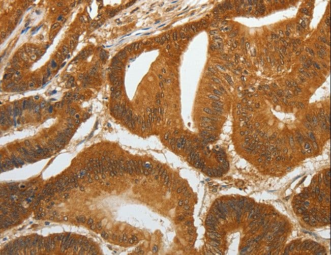 RETNLB / RELM-Beta Antibody