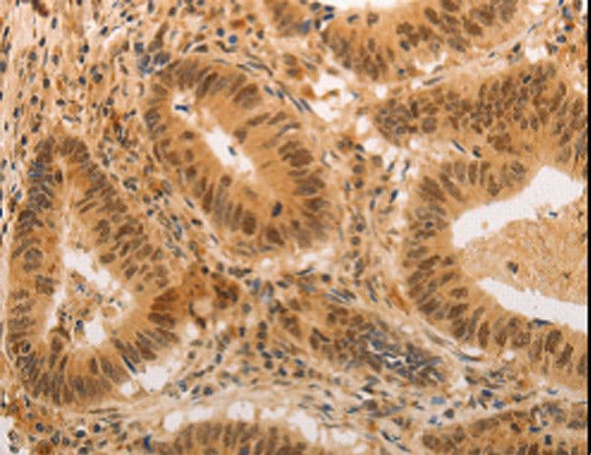 ADRA1B / Adrenoceptor alpha 1B Antibody