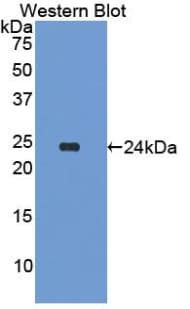 APCS / Serum Amyloid P / SAP Antibody (aa20-223, PE)