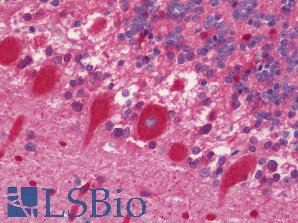 IHC-plus™ Polyclonal Rabbit anti-Human ENO3 / Enolase 3 Antibody (aa196-434, IHC, WB)