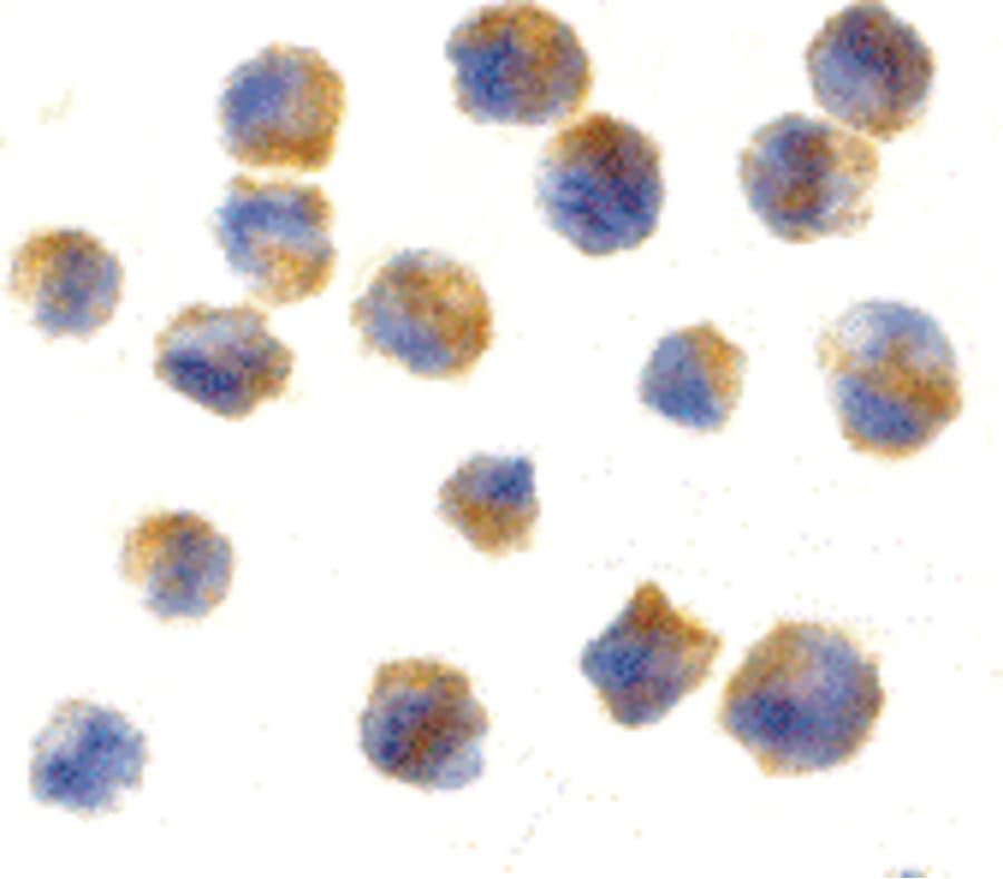 CBLN1 / Cerebellin 1 Antibody