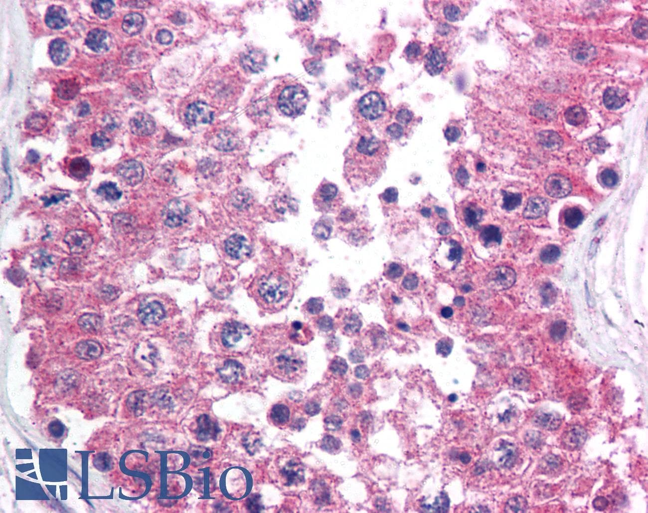 IHC-plus™ Monoclonal Mouse anti-Human RAD1 Antibody (clone 4126, N-Terminus, IHC, WB)