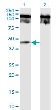 Monoclonal Mouse anti-Human TNFRSF19 / TROY Antibody (clone 1H6, WB)