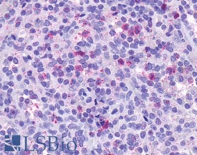 IHC-plus™ CCRL2 Antibody (Cytoplasmic Domain)