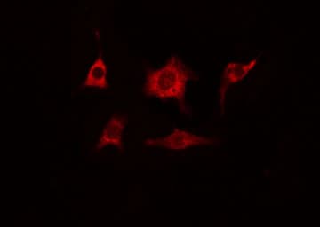 Polyclonal Rabbit anti-Human CEP78 / IP63 Antibody (IHC, IF, WB)