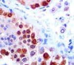 UCHL1 / PGP9.5 Antibody