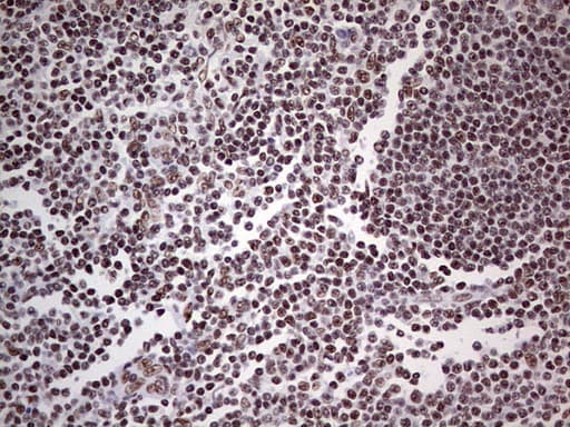 PPP1R8 / Rnase E Antibody (aa1-225, clone OTI5H9)