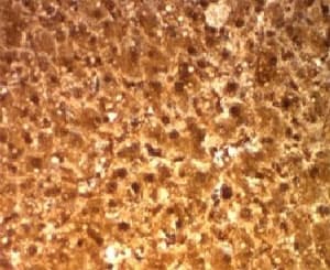 ARG1 / Arginase 1 Antibody (aa1-150, clone ARG1/1126)