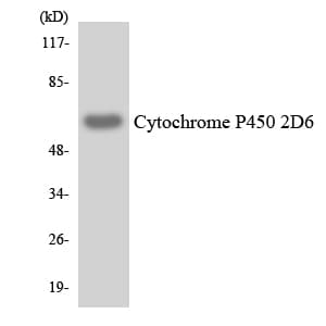 CYP2D6 Antibody (aa224-273)