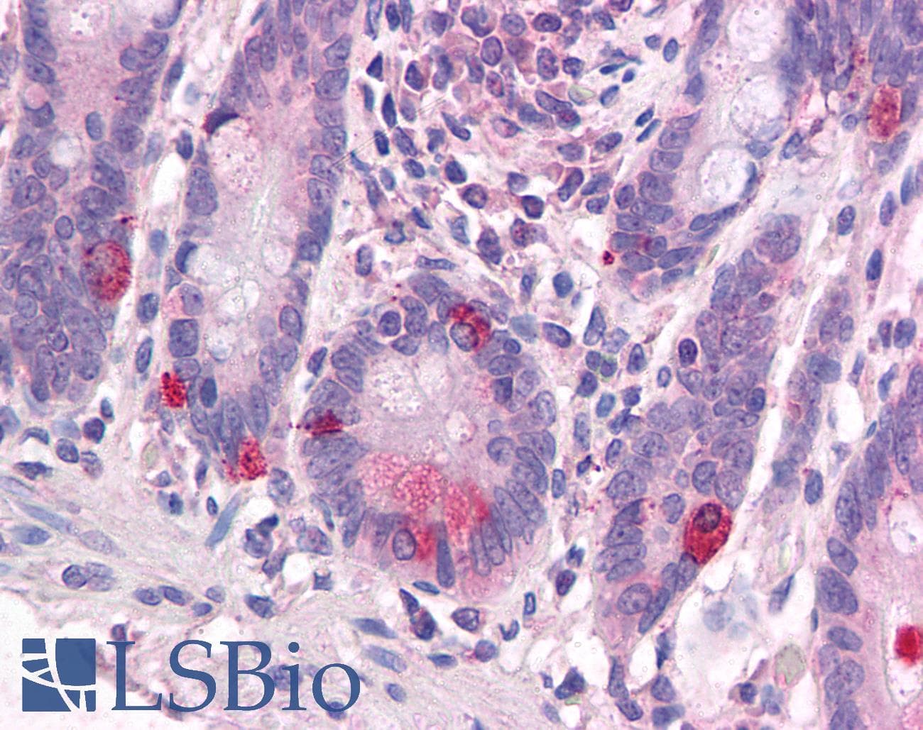 IHC-plus™ WNT1 Antibody (Internal)